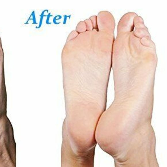 Emjoi Micro Pedi White Callus Remover with Extra Coarse Roller & Cleaning Brush - Picture 5 of 9